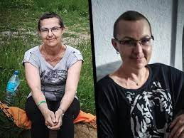 Dwa zdjęcia przedstawiające kobietę.